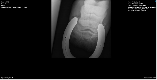 Left Forenavicular D65PR PADIO